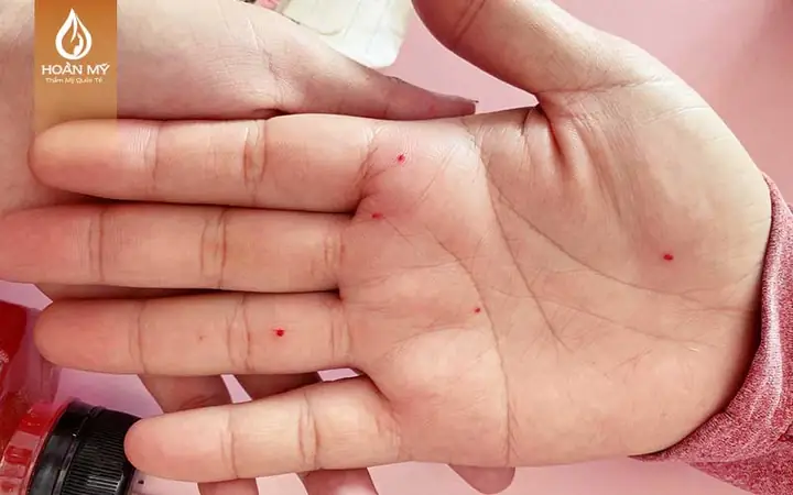 Cách Chấm Nốt Ruồi Phong Thủy