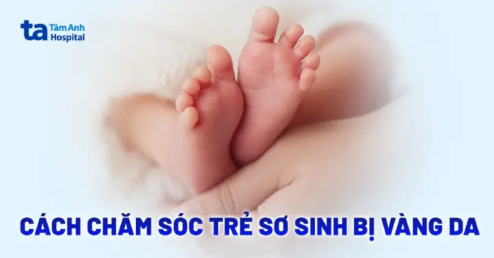 Đánh Giá Vàng Da Ở Trẻ Sơ Sinh