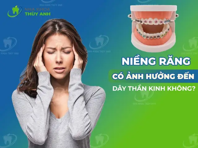 Làm Răng Có Ảnh Hưởng Phong Thủy