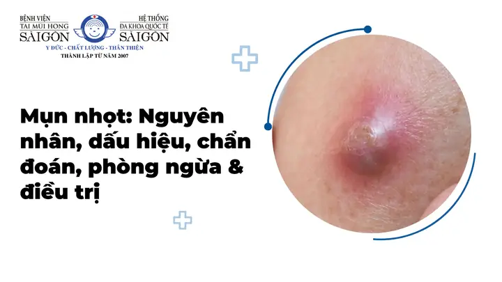 Nguyễn Trí Hiếu Nhận Định Giá Vàng Trong Năm 2020