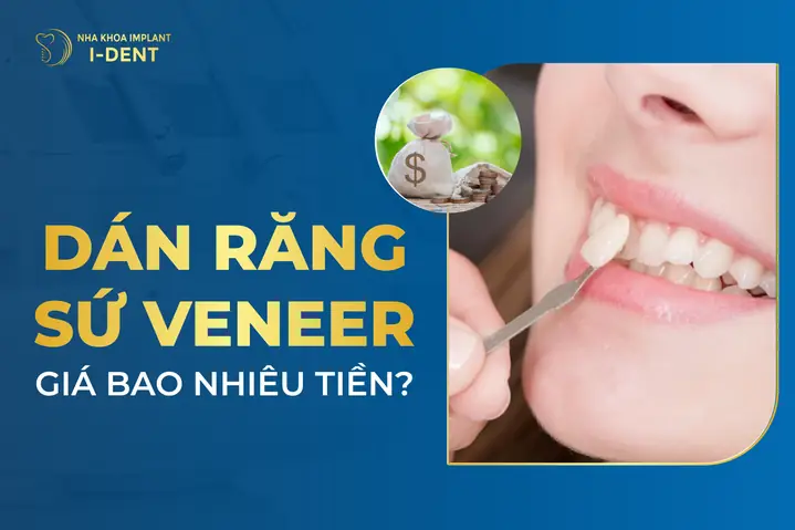 Tẩy Ố Vàng Răng Cả Liệu Trình Giá Bao Nhiêu