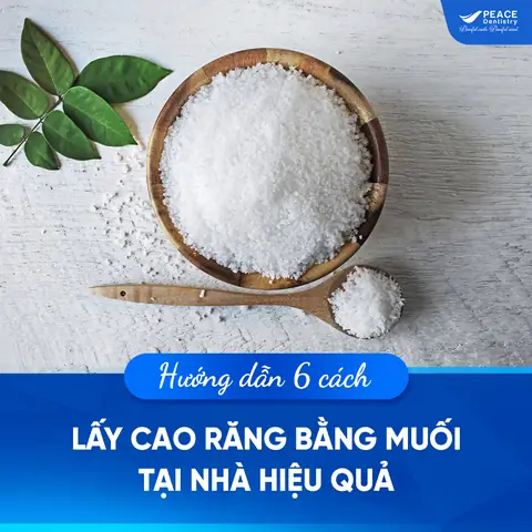 Túi Muối Hành Kim Phong Thủy